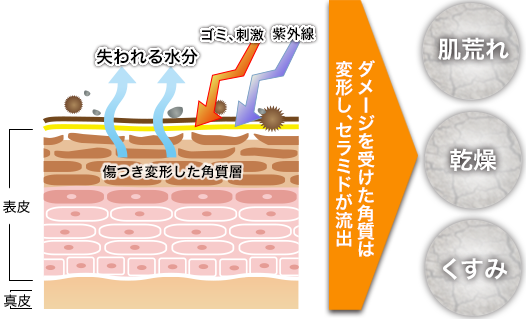ダメージを受けた角質は変形し、セラミドが流出